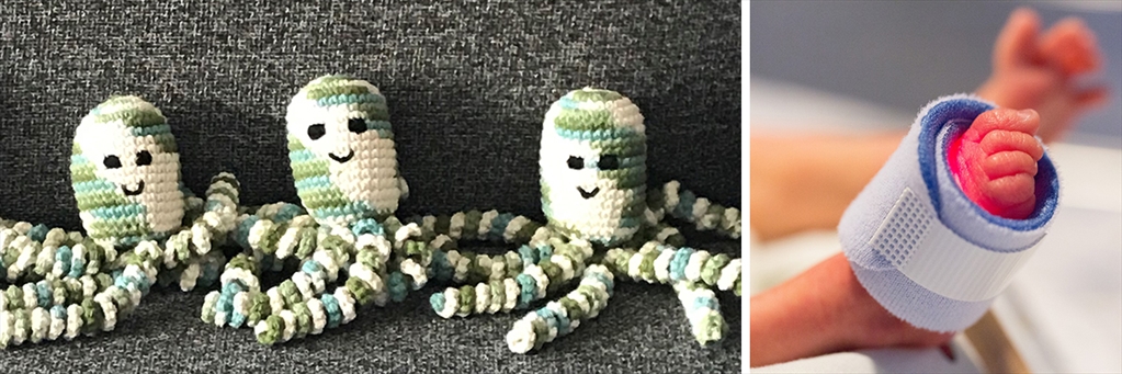 Crochet octopuses and feet of premature baby